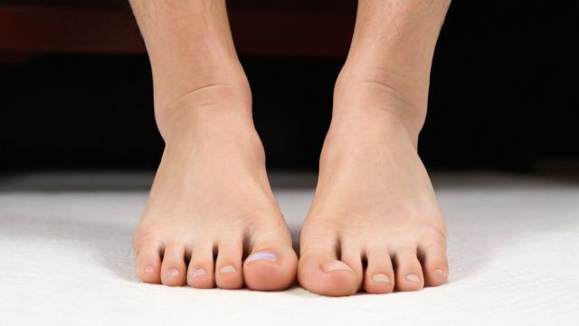 如何查看me9435a的脚?